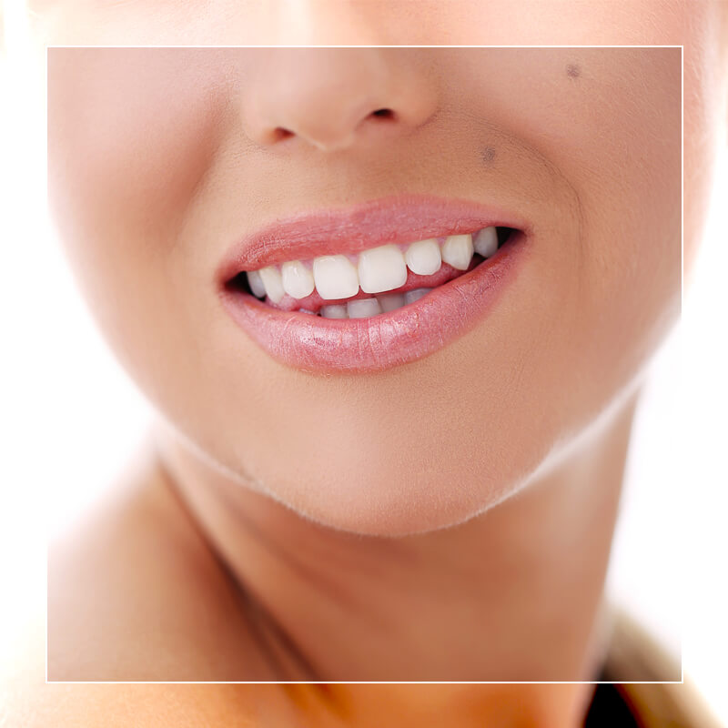 dentacann dentifricio al carbone vegetale